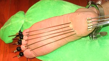 Needles in the feet